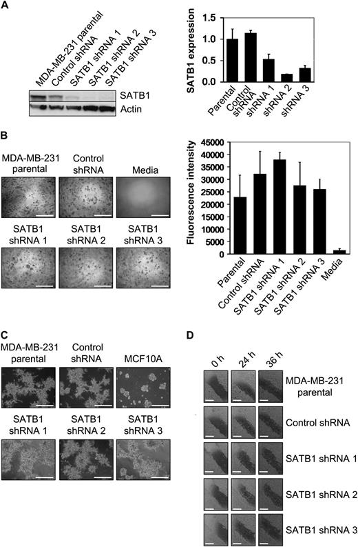  Effect of SATB1 depletion on the aggressive cancer cell phenotype in vitro. For these experiments, we used SATB1 short hairpin RNA (shRNA) 1, 2, and 3 MDA-MB-231 cells, control shRNA MDA-MB-231 cells, and parental MDA-MB-231 cells. A ) SATB1 mRNA and protein expression. Left ) SATB1 protein expression by immunoblot analysis. Actin protein expression was the loading control. Right ) SATB1 mRNA expression by quantitative real-time reverse transcription–polymerase chain reaction analysis. Data are expressed as normalized SATB1 expression, which was calculated relative to expression of endogenous GAPDH mRNA control and adjusted relative to the expression of GAPDH normalized SATB1 expression in parental MDA-MB-231 cells. SATB1 mRNA experiments were repeated three times, with each point in triplicate. Error bars = 95% confidence intervals. B ) Colony formation in soft agar after 8 days of culture. Left ) Representative micrographs of colonies. The experiment was performed twice, with triplicate samples. Scale bars = 1 mm. Right ) Quantification of colony formation in soft agar after 8 days of culture. To measure colony formation, agar was solubilized, cells were lysed, and the number of cells in the colonies was assessed by use of CyQuant GR Dye with a fluorescence plate reader. Fluorescence intensity is directly proportional to cell number. The experiment was performed twice, with triplicate samples. Error bars = 95% confidence intervals. C ) Acinar morphology after 5 days of culture on matrigel. MCF10A cells were used as a control for normal mammary epithelial cell acinar formation. Invasive protrusions from acinar demonstrate aggressiveness. Representative micrographs are shown. The experiment was performed twice, with triplicate samples. Scale bars = 1 mm. D ) Cell migration as assessed by wound healing. Confluent cell cultures, as indicated, were wounded by scratching a single wound through the middle of the cell monolayer with a 200-μL pipette tip and, wounds were photographed 0, 24, and 36 hours after wounding. Rates of cell migration are shown by closing of the wounds. Representative micrographs are shown. The experiment was performed twice, with triplicate samples. Scale bars = 0.5 mm. 