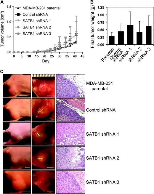  Effect of SATB1 depletion on the aggressive cancer cell phenotype in vivo. For these experiments, we used SATB1 short hairpin RNA (shRNA) 1, 2, and 3 MDA-MB-231 cells, control shRNA MDA-MB-231 cells, and parental MDA-MB-231 cells. Mice (n = six mice per group) were injected with 2 × 10 5 SATB1 shRNA cells (ie, pooled populations of shRNA silenced cells that were obtained after 5 days of drug selection without subcloning), control shRNA cells, or parental MDA-MB-231 cells into the fourth mammary fat pad from flank to obtain one tumor per mouse. A ) Tumor volume. Tumors were measured with vernier calipers, and volume was calculated with the formula L × W2 × 0.4 (where 1 cm 3 = 1 g). Each data point is the mean value of four to six primary tumors. Error bars = 95% confidence intervals. B ) Final tumor weight. Tumors were removed at necropsy on day 42 after injection and weighed. Each data point is the mean value of four to six primary tumors. Error bars = 95% confidence intervals. C ) Photographs of representative mice ( left column , scale bar = 5 mm) and of tumors in their mammary fat pads ( center column , scale bar = 5 mm) and micrographs of tumor sections stained with hematoxylin–eosin ( right column , scale bar = 50 μm). 