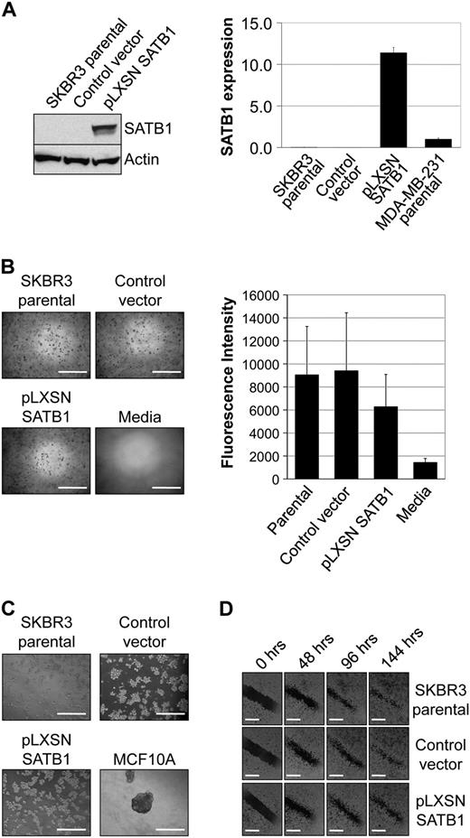  Effect of SATB1 expression on the aggressive cancer phenotype in vitro. For these experiments, we used SKBR3 pLXSN SATB1 cells that overexpress SATB1 mRNA and protein, pLXSN control vector SKBR3 cells, parental SKBR3 cells, and MDA-MB-231 breast cancer cells in which SATB1 is expressed at physiologically relevant levels. A ) SATB1 mRNA and protein expression. Left ) SATB1 protein expression by immunoblot analysis. Actin protein expression was the loading control. Right ) SATB1 mRNA expression by quantitative real-time reverse transcription–polymerase chain reaction analysis. Data are expressed as normalized SATB1 mRNA expression, calculated relative to expression of the endogenous GAPDH mRNA control, and adjusted relative to expression in control MDA-MB-231 cells. The experiment was repeated three times, with each point in triplicate. Error bars = 95% confidence intervals. B ) Colony formation in soft agar after 8 days of culture. Left ) Representative micrographs of colonies. Scale bars = 1 mm. Right ) Quantification of colony formation in soft agar after 8 days of culture. To measure colony formation, agar was solubilized, cells were lysed, and the number of cells in the colonies was assessed by use of CyQuant GR Dye with a fluorescence plate reader. Fluorescence intensity is directly proportional to cell number. The experiment was performed four times, with triplicate samples. Error bars = 95% confidence intervals. C ) Acinar morphology after 5 days of culture on matrigel. MCF10A cells were used as a control for normal mammary epithelial cell acinar formation. Invasive protrusions from acinar demonstrate aggressiveness. Representative micrographs are shown. The experiment was performed twice, with triplicate samples. Scale bars = 1 mm. D ) Cell migration as assessed by wound healing. Confluent cell cultures, as indicated, were wounded by scratching a single wound through the middle of the cell monolayer with a 200-μL pipette tip, and wounds were photographed 0, 48, 96, and 144 hours after wounding. Rates of cell migration are shown by closing of the wounds. Representative micrographs are shown. The experiment was performed twice, with triplicate samples. Scale bars = 0.5 mm. 