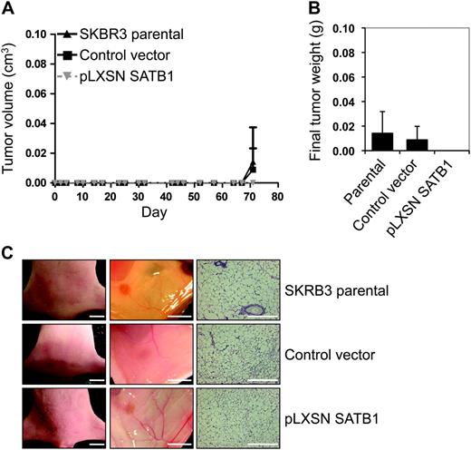  Effect of SATB1 expression on the aggressive cancer phenotype in vivo. For these experiments, we used SKBR3 pLXSN SATB1 cells that overexpress SATB1 mRNA and protein, pLXSN control vector SKBR3 cells, and parental SKBR3 cells. Mice (n = six mice per group) were injected with 2 × 10 5 pLXSN SATB1 cells, control vector cells, or parental SKBR3 cells into the fourth mammary fat pad from flank to obtain one tumor per mouse. A ) Tumor volume. Tumors were measured with vernier calipers, and volume was calculated with the formula L × W2 × 0.4 (where 1 cm 3 = 1 g). Each data point is the mean value of six tumors. Error bars = 95% confidence intervals. B ) Final tumor weight. Tumors were removed at necropsy on day 72 after injection and weighed. Each data point is the mean value of six tumors. Error bars = 95% confidence intervals. C ) Photographs of representative mice ( left column , scale bar = 5 mm) and their mammary fat pads ( center column , scale bar = 5 mm) and micrographs of mammary fat pad tissue sections stained with hematoxylin–eosin ( right column , scale bar = 50 μm). 