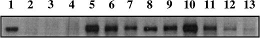 Example of a western blot showing AIB1 expression from extracts of 12 representative tumors. Lane 1 is the standard (5 μg of MCF-7 extract protein) that was used to normalize AIB1 levels between blots. Protein (20 mg) was added to each lane.