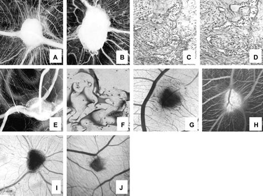  Effect of bortezomib on angiogenesis in chick chorioallantoic membranes (CAMs). Macroscopic ( A, B ) and microscopic ( C, D ) images of the angiogenic response induced by gelatin sponges soaked with recombinant fibroblast growth factor-2 ( A, C ) or with HTLA-230 cell-conditioned medium ( B, D ). Macroscopically, numerous allantoic vessels converged radially in a “spoked wheel” pattern toward the implant ( A, B ), whereas microscopically, numerous small blood vessels were detectable among the sponge trabeculae ( C, D ). Following treatment of the CAM with 20 nM bortezomib, fewer vessels surrounded the sponges and were recognizable among the trabeculae of the specimens treated with the conditioned medium of HTLA-230 cells ( E, F ). Similar features were observed when CAMs were treated with neuroblastoma biopsy specimens ( G ) or with tumor xenografts derived from mice injected intravenously with HTLA-230 cells ( H ). Following treatment with 20 nM bortezomib, fewer blood vessels invaded the biopsy specimen ( I ) or the xenograft ( J ). Original magnifications: panels A, B, E, G, H, I, and J: ×50; panels C, D, and F: ×250. 