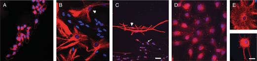 Glial fibrillary acidic protein (GFAP)+ cells showed 3 types of morphology and staining. (A) The majority of cells grown in the presence of growth factor were small, round, or fusiform, and stained diffusely for GFAP. (B) Some cells grown under differentiating conditions developed the morphology and filamentous GFAP staining of mature type 1 astrocytes (arrowhead). (C) Both immature (arrow) and mature (arrowhead) GFAP+ cells were present in differentiation cultures. (D) At P10, GFAP+/mature cells had a diffuse staining pattern. (E) Comparison of filamentous (top panel; P5) and diffuse (bottom panel; P10) staining in GFAP+ cells with mature type 1 astrocyte morphology. Scale bar = (A, B, D, E) 25 μm; (C) 50 μm.