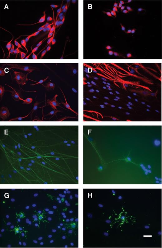 Immunophenotyping of olfactory bulb-derived canine neural progenitor cells (OB-cNPCs). (A, B) Undifferentiated cultures. The majority of cells stained positively for nestin (A) and glial fibrillary acidic protein (GFAP) (B). Cells are uniformly unipolar or bipolar with a simple, immature morphology. (C--H) Differentiated cultures (growth factor withdrawal). The intensity of nestin staining (C) decreases and mature cellular morphology is noted for both nestin+ (C) and GFAP+ (D) cells. (E--H) Some OB-cNPCs stain positively for neuronal markers β-tubulin III (E) and Map2ab (F) and oligodendrocytic markers O4 (G) and GalC (H)). The appropriate morphology for astrocytes (D), neurons (E, F), and oligodendrocytes (G, H) is observed. Scale bar = 25 μm.