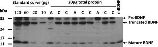 自闭症（A）和对照（C）样本梭状回匀浆的代表性蛋白质印迹。通道1至通道4：标准曲线加载的总蛋白量不同。通道5至13：每个自闭症和对照样本的总蛋白20μg。泳道14：0.3纳克重组人BDNF。