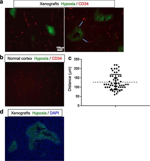  Anatomical correlation of hypoxia areas and blood vessels in the orthotopic MGG123 xenografts. (A, B) Immunofluorescence evaluation of the presence of hypoxic areas (green) and CD34-positive blood vessels (red) in orthotopic xenografts ( A , representative images from 2 animals) and the contralateral normal cerebral cortex (B) . (C) Plot showing the result of measurements of distances between CD34-positive blood vessels and the nearest hypoxic area. Examples of such distances are shown with blue lines in the right panel of (A) . (D) Merged image of hypoxia (green) and DAPI (blue) showing absence of cells at the center of a large region of hypoxia. 