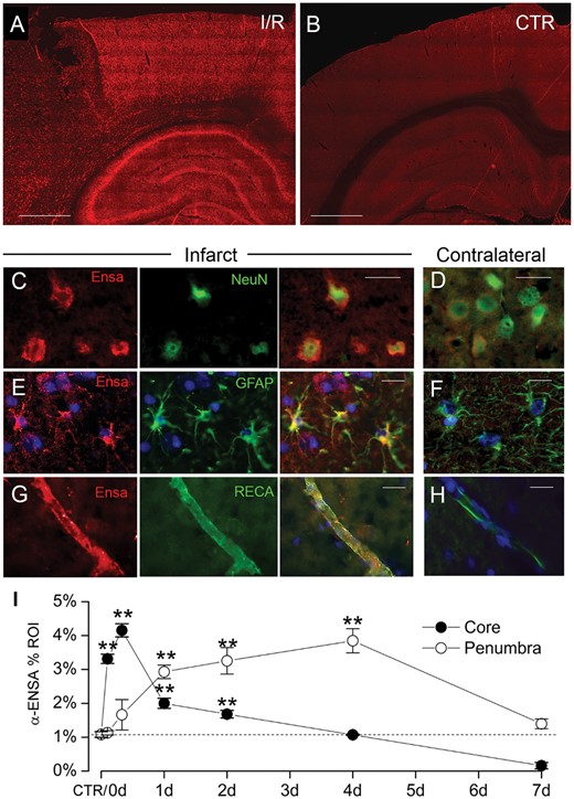 Upregulation of αEnsa protein in rat tMCAo is detected using a polyclonal rabbit-anti-αEnsa primary antibody. Immunofluorescence results in rat tMCAo (A) and control brain (B), using a polyclonal rabbit-anti-αEnsa primary antibody. Double label immunofluorescence reveals prominent upregulation of αEnsa protein in NeuN-positive neurons (C), GFAP-positive astrocytes (E), and rat endothelial cell antigen-1 (RECA-1) positive endothelial cells (G) in ischemic tissues versus nonischemic contralateral controls (D, F, and H, respectively); merged double label images are shown in the third and fourth columns. Quantification of αEnsa protein expression in core versus peri-infarct regions at various times after MCAo, as indicated (I); 6 rats/group; **p < 0.01; original magnification, 20× (A, B) or 40× (C–H); scale bars, 100 µm (A, B); 10 µm (C–H); αEnsa, red/CY3; NeuN, GFAP, and RECA, green/FITC; nuclei, blue/DAPI. Images shown are from specimens 24 hours after ischemia/reperfusion.