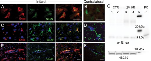 Upregulation of αEnsa protein in rat tMCAo is detected using a monoclonal mouse-anti-αEnsa primary antibody. Double label immunofluorescence reveals prominent upregulation of αEnsa protein in NeuN-positive neurons (A), GFAP-positive astrocytes (C) and PECAM (CD31)-positive endothelial cells (E) in ischemic tissues, versus nonischemic contralateral controls (B, D, and F, respectively); merged double label images are shown in the third and fourth columns; original magnification, 40× (A–F); scale bars, 10 µm; αEnsa, red/CY3; NeuN, GFAP, and PECAM (CD31), green/FITC; nuclei, blue/DAPI. Images shown are from specimens 24 hours after ischemia/reperfusion. Immunoblot of αEnsa and Hsc70 protein expression in control versus peri-infarct region following 2 hours ischemia and 4 hours reperfusion in rat MCAo (data shown from 2 controls and 2 animals with tMCAo, representatiave of 6 independent experiments); molecular weight ladder in lane 5 and human recombinant αEnsa (positive control) in lane 6 (G).