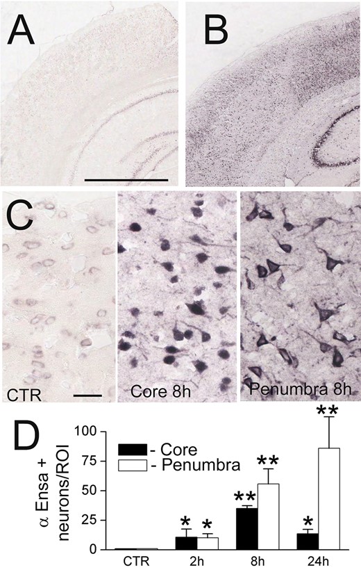 ENSA mRNA is upregulated in rat tMCAo. In situ hybridization for ENSA in control brain (A) and brain 24 hours after ischemia/reperfusion in rat tMCAo (B, C), shown at low (B) and high (C) magnification. Quantification of ENSA in core versus peri-infarct region at various times after MCAo, as indicated (D); 3 rats/group; *p < 0.05; **p < 0.01.