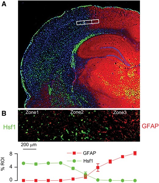 Inverse expression of HSF1 and GFAP across the ischemic gradient, with localization of the ischemic penumbra. Montage of high-power images in rat showing distinct molecular zones defined by GFAP and HSF1 immunolabeling, with Zone 1, a GFAP–/HSF1+ region representing the ischemic core; Zone 2, a GFAP+/HSF1+ area of transition; and Zone 3, a GFAP+/HSF1– area adjacent to normal tissue (A). High-power image of transition zone, with quantification of GFAP and HSF1 labeling in 10 adjacent high-power fields (40×), from left to right across the ischemic gradient (B); mean ±SE; n = 6 brains; original magnification, 20× (A) or 40× (B); GFAP, red/CY3; HSF1, green/FITC; nuclei, blue/DAPI. Images shown are from specimens 24 hours after ischemia/reperfusion.