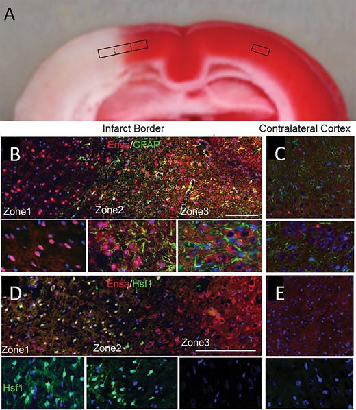 αEnsa protein is differentially expressed in distinct zones of ischemic rat brain. Triphenyltetrazolium chloride (TTC)-stained coronal section of rat tMCAo, with depiction of distinct boxed zones (A). Immunofluorescent montage images of ischemic rat cortex reveal qualitative differences in αEnsa protein expression in distinct regions of ischemic cortex (B, D), relative to controls (C, E); original magnification, 20× (B–E, upper panels); 40× (B–E, lower panels); scale bars, 100 µm (upper panels); 10 µm (lower panels); αEnsa, red/CY3; GFAP and HSF1, green/FITC; nuclei, blue/DAPI. Images shown are from specimen 24 hours after ischemia/reperfusion.