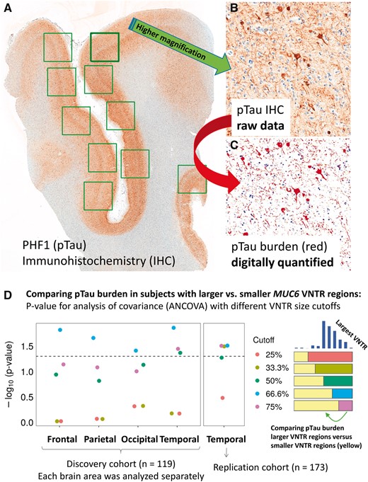 Digital quantification of Alzheimer disease (AD) pTau pathologic burden, for correlation with the size of the MUC6 VNTR polymorphism in 119 subjects (Discovery cohort) followed by additional analyses of 173 separate subjects (Replication cohort). (A–C) Panels show representative results of pTau immunohistochemistry (IHC) from the superior and middle temporal gyri (Brodmann areas 21/22) of a person who died with severe dementia. The primary pTau immunostain is shown in panel (A), and at higher magnification in panel (B). The false-colored data shown in panel (C) conveys what was detected by the software and quantified to provide an assessment of pTau burden in each section. These parameters from different brain regions, among individuals in the University of Kentucky AD Center autopsy cohort (Table 1), were analyzed to compare the amount of pTau burden in subjects stratified by the size of the largest detected MUC6 VNTR region according to the PCR assay. (D) p Values (y axis as -log10 scale) from analysis of covariance (ANCOVA) tests, applying different VNTR size cutoffs for the comparisons, and correcting for APOE genotype, age at death, and sex. Each brain region in the Discovery cohort was analyzed separately, but the results were notably consistent. The dashed line indicates a p value of 0.05. The results with lowest p values were in the comparisons wherein pTau burdens were compared between subjects with the largest 33.3%ile (tertile) MUC6 VNTRs versus the other samples. See Table 2 for more detailed analyses of results for these and other parameters. Scale bars: A = 3 mm; B, C = 100 microns.