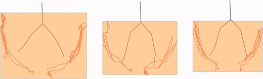 A front-view 2D image of ‘bird’ gestured by a single participant across all three gesture-only rounds. The gray skeleton represents the average position of the participant’s body in that round, while gesturing that item. The red lines indicate the position of the wrist over time in that item trial, and the orange squares represent a front-view of the volume of the gesture space for that item. (Colour online)