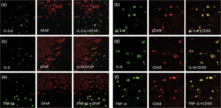 Double immunofluorescence staining of Case 2. IL-1α, IL-6 and TNF-α were not expressed in reactive astrocytes, as revealed by GFAP-positive cells (a, c, e), but were expressed in CD68-positive cells (b, d, f). The original objective magnification was ×400.