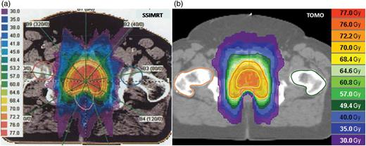 Examples of dose distribution in radiotherapy of the prostate gland with (a) SSIMRT and (b) TOMO.