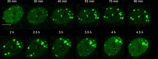 Representative time-lapse images at 41°C after γ irradiation. Bar = 5 μm.