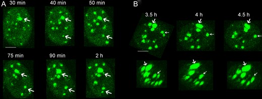 Different ways to increase the area of unrepaired IRIF in the IR+HT group. (A) Representative time-lapse images show the growth in individual IRIF area in situ (white arrows). Bar = 5 μm. (B) Representative images of the merging of adjacent IRIF in the x–y plane (upper panel) and x–z plane (lower panel). White arrows show the clustering process of the proximal IRIF. Bar = 5 μm.