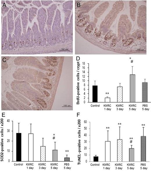 Representative image of BrdU immunoreactivity in the small intestine in KMRC011-treated irradiated C57BL/6N mice after 1 day (Panel A) or 5 days (Panel B) compared with the PBS 5 days group (Panel C). Panel D: Quantification of BrdU-positive cells in the crypt cells of the small intestine. Panel E: Quantification of SOD2-positive cells in the small intestine. Panel F: Quantification of TUNEL-positive cells in the small intestine. KMRC011 was intramuscularly injected 15 min after 11 Gy total-body irradiation (TBI), except for the control group. Data are expressed as mean ± SD (n = 6). *P < 0.05 and **P < 0.01 versus control group; #P < 0.05 versus PBS 5 days group, using two-tailed t-tests.