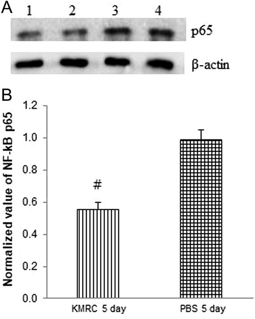 The expression of NF-κB p65 (Panel A; Lane 1 and 2: KMRC 5 days, Lane 3 and 4: PBS 5 days) in the small intestine of C57BL/6N mice by western blot analysis. Panel B: relative density of NF-κB p65. Intensities of the bands were measured against β-actin expression. KMRC011 was intramuscularly injected 15 min after 11 Gy total body irradiation (TBI), except for the control group. Data are expressed as mean ± SD (n = 6). #P < 0.05 versus the PBS 5 days group, using two-ailed t-tests.
