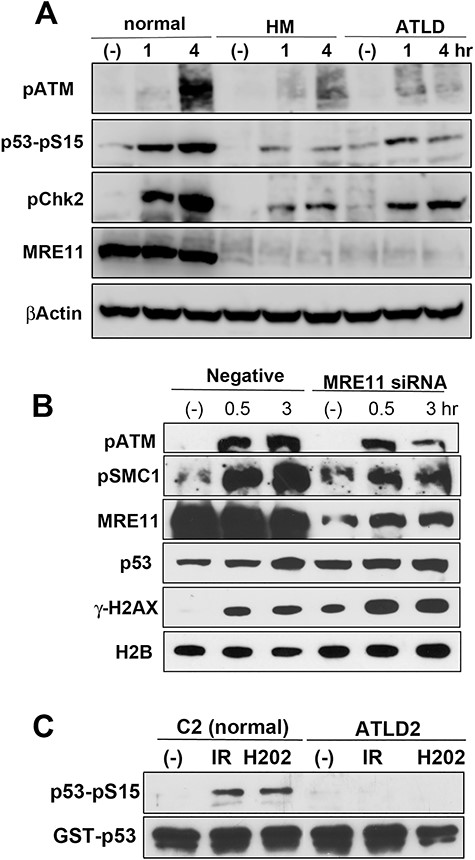 MRE11 participates in ATM activation following oxidative stress. (A) MRC5SV (normal), MRE11-defective HMfibroSV (HM) and ATLD2SV (ATLD) cells were treated with H2O2 (100 μM) for the indicated times and analysed using the indicated antibodies. (B) U2OS cells were transfected with MRE11 siRNA. After 2 days, these cells were treated with H2O2 (100 μM) for the indicated times and analyzsd using the indicated antibodies. (C) Normal (C2ABR) or ATLD2 (ATLD2ABR) lymphoblastoid cells were γ-ray-irradiated (10 Gy) or treated with 100 μM H2O2. After 1 h, cells were harvested and a kinase activity assay was measured using the immunocomplexes with an anti-ATM antibody. Phosphorylation was detected by western blot analysis using an anti-phospho-p53 antibody. The amount of substrate in the reaction was confirmed using an anti-GST antibody.