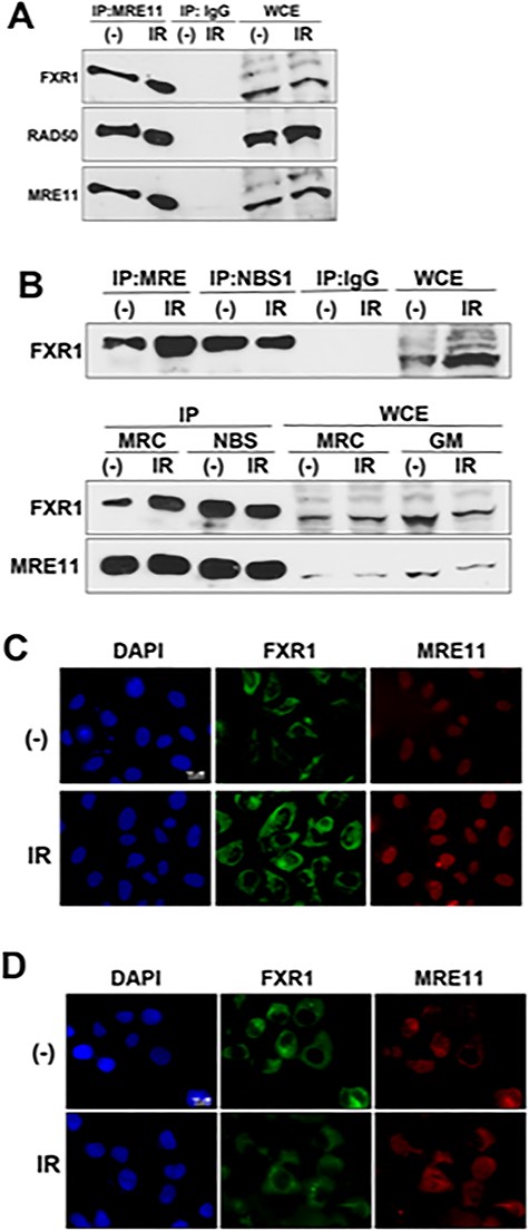 FXR1 interacts with MRE11. Extracts from C3ABR (A and B: upper panel), or MRC5SV (B: lower panel) and NBS1-defective NBS cells (B: lower panel) without (−) or with 10 Gy of IR were immunoprecipitated with anti-MRE11 antibody (Novus), anti-NBS1 antibody (Novus) or normal IgG, and then the immuno-complexes were detected by western blot analysis using the indicated antibodies. WCE = Whole cell extract. (C and D) Cytoplasmic distribution of FXR1. U2OS cells (C) or NBS cells (D) were irradiated with 5 Gy of IR. After 0.5 h, the cells were fixed and immuno-staining was performed using anti-FXR1 (Bethyl) and anti-MRE11 antibody (GeneTex).