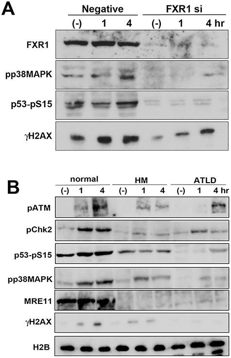 FXR1 participates in the oxidative stress responses. (A) U2OS cells were transfected with FXR1 siRNA or negative control siRNA, and after 2 days these cells were treated with 50 μM of pyocyanin for the indicated times. Whole cell extracts from the harvested cells were analysed by western blot using the indicated antibodies. (B) MRC5SV (normal) and MRE11-defective ATLD cells (HMfibroSV or ATLD2SV) were treated with 50 μM pyocyanin for the indicated times and whole cell extracts from the harvested cells were analysed by the indicated antibodies.