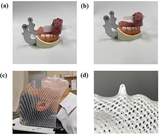 Tongue depressor function of the mouthpiece and fixation with a thermoplastic shell. If tongue depression is needed, the tongue can be pushed out caudally (a). If tongue depression is not needed, the mouthpiece can be flipped over (b). The mouthpiece is combined with a thermoplastic shell using the gripping part of the mouthpiece (c, d).