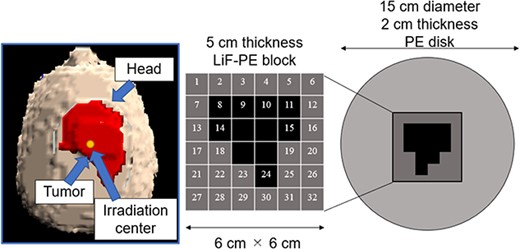 Tumor model and shape of the intensity modulator in an asymmetrical tumor case.