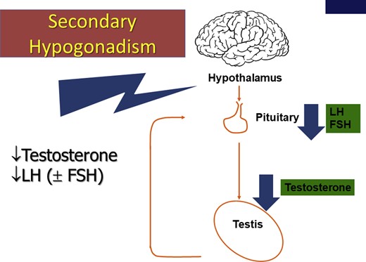 Secondary hypogonadism. FSH = follicle-stimulating hormone; LH = luteinizing hormone. Figure 2 is available in color at www.jsm.jsexmed.org.