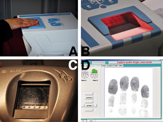 Fingerprint devices. (A) Fingerprint capturer: flat fingers of the right hand are scanned. (B) Fingerprint capturer: plastic board surrounds the fingerprint capture plate. Between the board and the plate, there is a split of approximately 1 mm height and 5 mm depth. (C) Index reader: leftovers of previous prints are clearly visible. (D) Real‐time image of (A) as displayed on the computer screen.