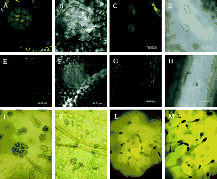 Expression analysis of the ATP fragment in glandular trichomes. Fluorescence and transmitted light imaging of GFP and GUS expression in trichomes. (A, B) Peltate trichome of pATP-GFP transgenic M.×piperita. (C, D) Capitate trichomes of the same plants. (E, F) Peltate trichomes of control plants. (G, H) Capitate trichomes of control plants. (I–K) Peltate and capitate trichomes of pATP-GUS transgenic M.×piperita. (L) Secretory trichomes of control N. tabacum. (M) Secretory trichomes of pATP-GUS transgenic N. tabacum.