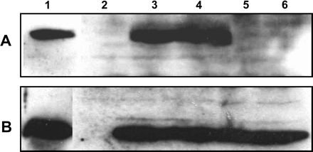 Western blot analysis of rice endosperm. Lane 1, positive control with total protein extract (10 μg) of CrtI-expressing E. coli cells (A) and of daffodil chromoplasts (B); lane 2, wild type; lane 3, transformed with pCarNew (CarNew E4-4, T1), lane 4 with pFun3 (Fun3 E3-5, T1), and lanes 5 and 6 with pCaCar (Hoa et al., 2003; lines CaCar 48-67-8-7, T3, and 29–35CR 13, T1). Detection was performed with anti-CrtI antibodies (A) and anti-PSY antibodies (B).