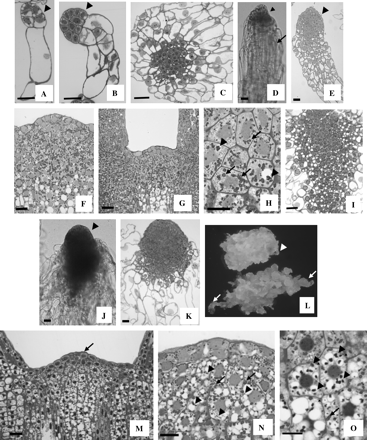 Embryonic development in the control line (A–H) and in lines overexpressing HBK3 (I–O). (A) A control pro-embryogenic mass I (PEMI) characterized by an elongated cell subtending a small cluster of cytoplasmic cells (arrowhead). (B) PEMII with a more elaborated suspensor region composed of vacuolated cells and an embryo proper (arrowhead) formed by a cluster of cytoplasmic cells. (C) PEMIII in which the vacuolated cells radiate from a central group of cytoplasmic cells. (D) External morphology of an immature control somatic embryo collected in the hormone-free medium (–PGR). The embryo is composed of a small embryo proper (arrowhead) and an elongated suspensor region (arrow). (E) Internal morphology of an immature control somatic embryo at a similar stage to that shown in (D). A differentiating protoderm (arrowhead) is visible within the embryo proper. (F) After 20 d in the ABA-containing medium the SAM of control embryos is fully formed and a heavy accumulation of starch is visible in both apical and subapical cells. (G) In fully developed cotyledonary embryos the SAM is generally dome shaped, although variations in shape are often observed. Accumulation of starch is prevalent in the subapical cells. (H) Starch (arrows) and, to a lesser extent, protein bodies (arrowheads) are visible in the cortical cells of fully developed control embryos. (I) In HBK3-S lines, the PEMsIII are composed of a large central group of cytoplasmic cells and a peripheral cluster of vacuolated cells. (J) External morphology of an immature HBK3-S embryo collected in the hormone-free medium (–PGR). The embryo is characterized by an enlarged embryo proper (arrowhead) and an extensive suspensor tail. (K) Internal structure of an embryo similar to that depicted in (B). (L) Morphology of control cells (top) and HBK3-S cells (bottom) cultured on solid hormone-free medium (–PGR) for 3 d. Large immature embryos (arrows) emerge from the HBK3-S embryogenic tissue. The size of the embryos is much smaller in control cells (arrowhead). (M) The shoot apical meristems of fully developed cotyledonary HBK3-S embryos are large and composed of defined cytoplasmic apical cells (arrows) and vacuolated subapical cells. (N) Both starch (arrows) and protein bodies (arrowheads) are visible within the cells of the shoot apical meristem. (O) Protein bodies (arrowheads) accumulate preferentially in the cortical cells. Reduced deposition of granules of starch (arrows) also occurs. Scale bar=20 μm.