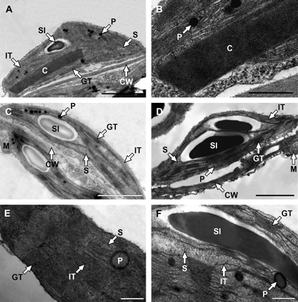 Transmission electron micrographs of representative chloroplast cross-sections taken from the intact leaves of tobacco expressing the Sho gene and four 35S enhancer elements (A, C) with detail of crystalloid (B) and control SR1 (D) tobacco growing under sterile conditions; and chloroplast cross-section detail taken from the leaf of transgenic dexamethasone-induced Sho (E) and control SR1 (F) tobacco cultivated in a greenhouse. C, crystalloid; CW, cell wall; GT, granal thylakoids; IT, intergranal thylakoids; M, mitochondrion; P, plastoglobuli; S, stroma; SI, starch inclusion. Bar=2 μm in A, C and D; and 500 nm in B, E and F.