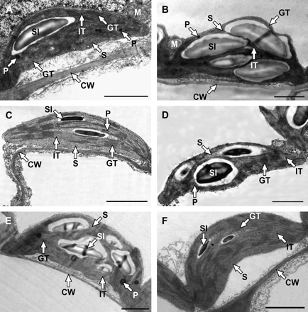 Transmission electron micrographs of representative chloroplast cross-sections taken from the intact leaves of transgenic 35S:AtCKX3 (A) and control SNN (B), transgenic 35S:Zm-p60.1 (C) and control SR1 (D), transgenic 35S:ZOG1 (E) and control W38 (F) tobacco. CW, cell wall; GT, granal thylakoids; IT, intergranal thylakoids; M, mitochondrion; P, plastoglobuli; S, stroma; SI, starch inclusion. Bar=2 μm.