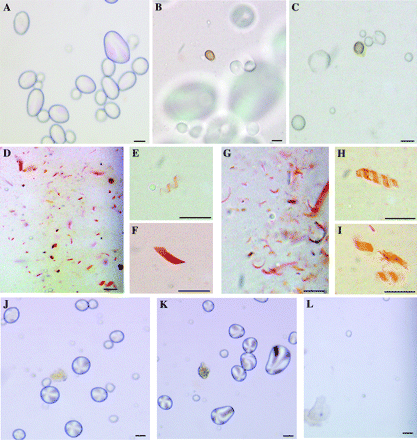 Microscope images of tissue lysates from potato tubers and carrot roots. (A) Lysate samples from tubers of vector-only control showing various sizes of amyloplasts and/or free starch grains. (B, C) Lysate samples from the newly harvested Or transgenic tubers of line L88, each containing an orange chromoplast (i.e. plastid membrane probably intact). (D) Numerous carotenoid-containing structures (accumulated along the edge of the cover slip) in preparation from the Or transgenic tubers of L88. (E, F) Carotenoid helix and flattened sheet, respectively, in preparation from the Or transgenic tubers. The helix was formed from a long sheet wrapped around the longitudinal axis of the structure. The flattened sheet in (F) could be a fragment of a helix structure. (G) Preparation from orange carrot root for comparison with (D). (H, I) Carotenoid-containing structures from carrot for comparison with (E) and (F), respectively. (J, K) Lysate samples from tubers of dark yellow-flesh potato cultivars, 91E22 and Yema de Huevo, respectively. Sparse coloured membrane structures were observed among the various sizes of amyloplasts and/or free starch grains. (L) Typical view of lysates from the dark yellow-flesh potato cultivars along the edge of the cover slip, which showed an absence of carotenoid-sequestering structures as seen in the Or transgenic tuber (D) or in carrot root (G). The bar in each figure represents 10 μm.