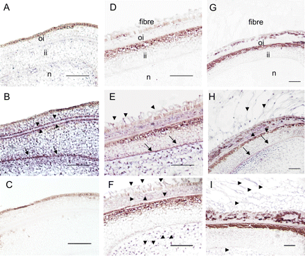 In situ mRNA localization of GhPEPC1 and 2 in cotton ovules and seeds. (A) Cross-section of ovules at –2 DAA hybridized with a GhPEPC1 sense probe as a negative control. (B) Cross-section of ovules at –2 DAA hybridized with a GhPEPC1 anti-sense probe. Note the absence of GhPEPC1 mRNA signals in the ovule epidermis but strong mRNA signals, indicated by the purple colour, in integument and nucellus, particularly at the interface between outer- and inner-integument (arrow heads) and at the innermost layer of inner integument (arrows). (C) Cross section of ovules at –2 DAA hybridized with a GhPEPC2 anti-sense probe. Note, no GhPEPC2 mRNA signals were detected. (D) Cross-section of seed at 1 DAA, hybridized with a sense probe of GhPEPC1. (E) Cross-section of seed at 1 DAA, hybridized with an antisense probe of GhPEPC1, showing the presence of GhPEPC1 mRNA in elongating fibres (arrows) in addition to that in the seed coat and nucellus. (F) Cross-section of seed at 1 DAA, hybridized with an antisense probe of GhPEPC2, showing the presence of its mRNA in elongating fibres in addition to that in the outer seed coat and nucellus (arrow heads). (G) Cross-section of seed at 5 DAA, hybridized with a sense probe of GhPEPC1. (H) Cross-section of seed at 5 DAA, hybridized with an anti-sense probe GhPEPC1. (I) Cross-section of seed at 5 DAA, hybridized with an antisense probe of GhPEPC2. oi, Outer integument; ii, inner integument; n, nucellus. Bars=50 μm.