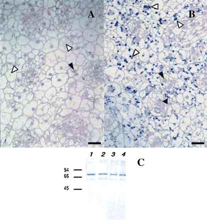 Comparison of the reaction of two groups of anti-CBP70 mAbs with CBP70 as examined immunocytochemically and with Western immunoblot analysis. LR White-embedded cross-sections of the stem apex of dark-grown 4-d-old maize seedlings were used. (A) Sections were incubated with mAbs against CBP70 of the first group (11B3) or (B) the second group (14A4), biotinylated anti-mouse antibody, and streptavidin-alkaline phosphatase conjugate. (A) mAb 11B3 detected CBP70 in nuclei (black arrowhead), but not in plastids (white arrowheads). (B) mAb 14A4 also detected CBP70 in nuclei (black arrowhead), but more effectively reacted with it in plastids (white arrowheads). Scale bars are 25 μm (A, B). (C) Western immunoblot detection of CBP70 isolated from nuclei and etioplasts of etiolated maize seedlings. Blots were probed with mouse anti-CBP70 mAbs of the first (11B3) or second (14A4) group, and the antibody was detected using the secondary anti-mouse antibody conjugated with alkaline phosphatase. Lanes 1, 2, CBP70 from nuclei was detected with mAb 11B3 (lane 1) or with mAb 14A4 (lane 2); lanes 3, 4, CBP70 from etioplasts was detected with mAb 11B3 (lane 3) or with mAb 14A4 (lane 4). Molecular weight standards in kDa are indicated on the left.