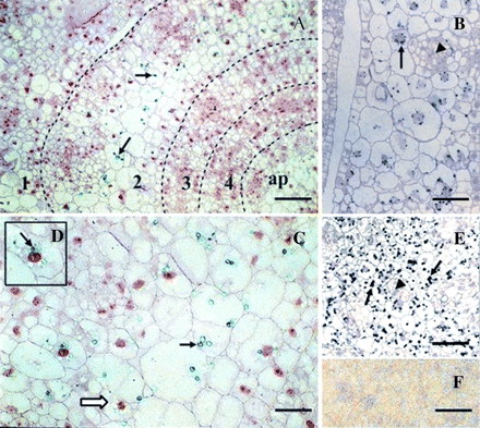 Immunolocalization of CBP70 on cross-sections of the node of etiolated maize seedlings. LR White-embedded sections of the node from dark-grown 4-d-old maize seedlings were analysed. Sections were incubated with mouse anti-CBP70 mAb of the second group (14A4), biotinylated anti-mouse antibody, and streptavidin-alkaline phosphatase conjugate. (F) A negative control was the same as in Fig. 2: sections were treated with non-immune serum. (A, C, D) Post-staining with safranin. (A) Immunochemically stained cross-section of the node. Broken lines designate the boundaries of leaves encircling the stem axis; figures indicate leaf numbers in the order of their formation; ap, stem apex. CBP70 was detected in plastids of the second leaf (black arrows). (C) A 2-fold magnification of the fragment of the second leaf. (D) Enlarged fragment of (C). (C, D) Plastid heterogeneity in CBP70 content is seen: plastids containing CBP70 (black arrow); plastids not containing CBP70 (white arrow). (B) Cross-section of the second leaf without post-staining with safranin. The arrangement of CBP70-containing plastids around the nucleus is seen (black arrow). (E) Stem apex without post-staining with safranin. A great amount of plastids containing CBP70 is seen (black arrows). (B, E) Plastids with CBP70 are absent from the zones of active cell division. CBP70 was recognized in these zones in the nuclei and cytoplasm (black triangles). Scale bars are 50 μm (A), 25 μm (B, C, E).