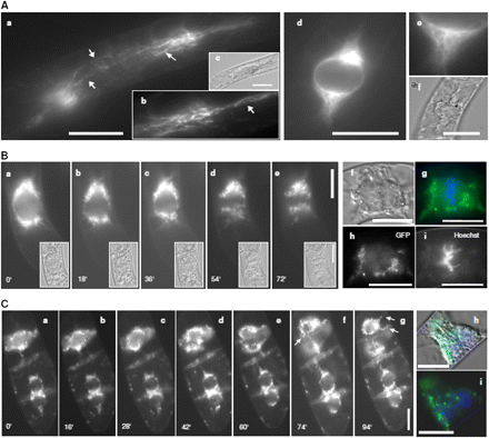 Localization of KCH1 during mitosis. (A) Transient expression of a YFP-fusion with OsKCH1-800 in tobacco BY-2 cells. Optical sections through the cell midplanes of premitotic BY-2 cells at different focus levels (a, b, d, e). The corresponding DIC image is given in (c, d). Arrows highlight punctate pattern on perinuclear filaments. (B, C) Preprophasic and prophasic tobacco BY-2 cells stably expressing a GFP-fusion with OsKCH1-800. The DNA was stained with Hoechst to determine the stage of mitosis. (B) A time-lapse series (see Supplementary Video S1 at JXB online) shows GFP OsKCH1 signals in tobacco BY2 cells during the early stages of mitosis, from prophase to early anaphase, together with the corresponding DIC images (a–e). In addition, a double-staining of GFP OsKCH1 (h) with Hoechst (i) during metaphase is shown (see merge in g). The corresponding DIC image is given in (f). (C) Time-lapse series (see Supplementary Video S2 at JXB online) of GFP OsKCH1 localization in tobacco BY-2 cells during late telophase and the beginning of cytokinesis. A double-staining of GFP OsKCH1 with Hoechst is shown in (i) together with a merge including the DIC image (h). Arrows highlight filaments that tether the nuclei to the periphery (g), and bridge the nucleus and the new cell wall (f). Scale bars: 20 μm. (This figure is available in colour at JXB online.)