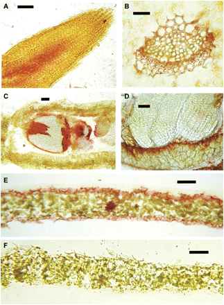 Enzyme histochemical detection of GGT activity in different tissues of A. thaliana. Tissue sections were incubated in a solution containing γ-glutamyl-p-nitroanilide and stained with Fast Garnet GBC. Reddish to purplish-brown staining indicates deposition of diazonium salts at the site of GGT activity: (A) root tip, longitudinal section; (B) vascular bundle, leaf cross-section; (C) silique, longitudinal section; (D) silique, seed magnified; (E) leaf, cross-section; (F) leaf cross-section in 10 mM serine/borate to inhibit GGT activity. Scale bars: A–D=100 μm; E, F=200 μm.