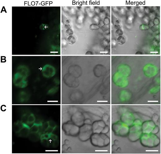 Amyloplast localization of FLO7–GFP in endosperm cells. Confocal microscopy images showing the localization of FLO7–GFP in developing endosperm at 2 (A), 4 (B) and 6 (C) DAF. The stroma in the amyloplast is indicated by white arrows. Bars, 5 μm.