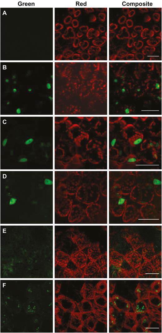 Characterization of the nuclear localization signal for SlSPL-CNR. (A) Mock-inoculated N. benthamiana (Nb) leaf cells as a negative control. (B–F) Nb leaf cells expressing SlSPL-CNR:GFP (B), SlSPL-CNR123:GFP (C), SlSPL-CNR1235:GFP (D), SlSPL-CNR4:GFP (E), or SlSPL-CNR12345:GFP (F). Nb leaves were taken at 7 d post-inoculation and examined under a confocal microscope. Scale bar: 100 μm.