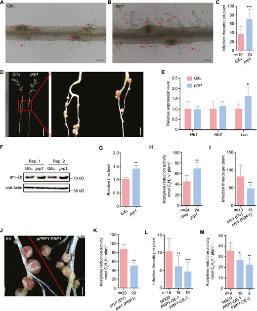PRP1 negatively regulates nodule symbiosis. (A–C) Infection thread phenotype of wild-type Gifu (A) and the prp1 mutants (B) inoculated with M. loti MAFF303099 containing a LacZ report gene at 5 d post-inoculation. Numbers of infection threads in WT and prp1 mutants at 5 d post-inoculation (C). Scale bars, 0.2 mm in (A–B). (D) Nodule phenotypes of WT and the prp1 mutant at 21 d post-inoculation. Scale bars, 1 cm (left) and 2 mm (right). (E) Relative expression of Hb1, Hb2, and Lbs in WT and prp1 mutant nodules at 21 d post-inoculation. Expression levels were normalized against the reference genes ATPase and ubiquitin. (F–G) Lbs levels of WT and prp1 mutant nodules at 21 d post-inoculation with M. loti MAFF303099 determined by western blotting using an anti-Lb antibody. Actin was used as the loading control. Representative pictures are shown in (F) and relative protein levels are shown in (G). (H) Acetylene reduction activity of nodules in WT and prp1 mutants at 21 d post-inoculation with rhizobium. (I–K) Complementation of prp1 mutants. Transgenic roots of the prp1 mutant expressing empty vector (EV) or PRP1 under the control of the endogenous promoter, were inoculated with M. loti MAFF303099. Numbers of infection threads at 7 d post-inoculation (I), images of nodules at 21 d post-inoculation (J), and acetylene reduction activity of nodules at 21 d post-inoculation (K) were measured. Scale bars, 0.5 mm (J). (L) Numbers of infection threads in the roots of WT MG20 and two independent PRP1 overexpression lines (PRP1-OE-1 and PRP1-OE-2) at 5 d post-inoculation with M. loti MAFF303099 containing a LacZ reporter. (M) Acetylene reduction activity of nodules at 21 d post-inoculation in MG20 and PRP1 overexpression plants. All values are means ±SD. Data were analysed using a two-tailed Student’s t-test. *P<0.05, **P<0.01, ***P<0.001. ‘n’ indicates the number of plants analysed.