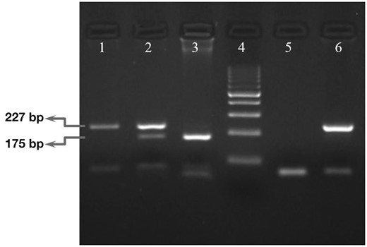 Polymerase chain reaction–restriction fragment length polymorphism (PCR-RFLP) electrophoresis results of IFNL4 rs368234815 polymorphism. Lanes 1, 2, and 3 were genotyped as TT/TT, TT/ΔG and ΔG/ΔG, respectively, for IFNL4 rs368234815. Lane 4 was a 100-bp ladder. Lanes 5 and 6 were no template control and nondigested PCR product, respectively. For electrophoresis of digested polymerase chain reaction (PCR) products, 3% agarose gel was used.
