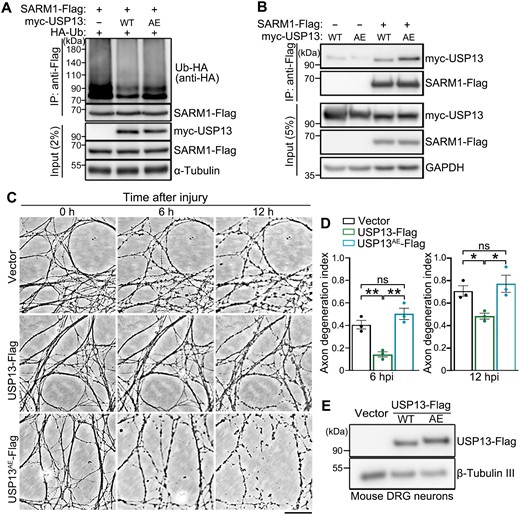 USP13 deubiquitinates SARM1 and its axonal protective effect requires the deubiquitinase activity.(A, B) Representative Western blot images showing the ubiquitination levels of SARM1 in HEK293T cells co-expressed with WT USP13 or USP13AE (A) and the interaction between them and SARM1 (B). (C, D) Representative phase contrast images (C) and quantification (D) of injury-induced axon degeneration in primary mouse DRG neurons infected with the lentivirus expressing WT USP13 or USP13AE. Images were captured live at the indicated time points after axotomy. (E) Western blot assay confirming the lentiviral expression of WT USP13 or USP13AE in the in vitro cultured mouse DRG neurons. hpi, hours post injury. Mean ± SEM; n = 3. *p < 0.05, **p < 0.01; ns, no significance; one-way ANOVA. Scale bar: 50 µm.
