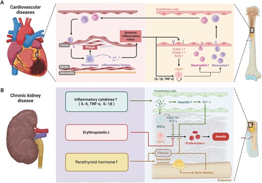Cardiovascular disease and chronic kidney disease influences hematopoiesis and bone marrow niche. (A) Cardiovascular disease influences monocytes and neutrophils production together with change of adhesion molecules in vascular endothelial cells to regulate their trans-endothelial migration. The myeloid cell participates in the plaque formation in cardiovascular disease. (B) CKD is coupled with increased inflammatory cytokine production, reduced red blood cell generation and release of parathyroid hormone.