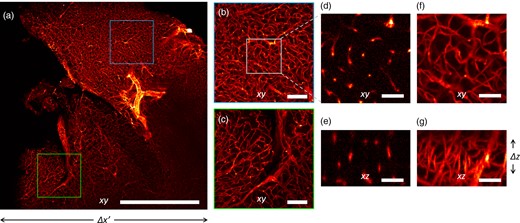 Imaging of a mouse brain at 5× magnification. (a) Maximum Intensity Projection of the reconstructed volume. (b,c) Magnified details of the blue and green boxes in panel (a), respectively. (d,f) Magnified detail of the white square in panel (b), shown in a single xy plane and as Maximum Intensity Projection, respectively. (e) Detail of the xz plane, perpendicular to the plane shown in panel (d). (g) Maximum Intensity Projection of the region shown in panel (e). Scale bar is 1 mm in (a), 250 μm in (b,c), and 40 μm in (d,g).
