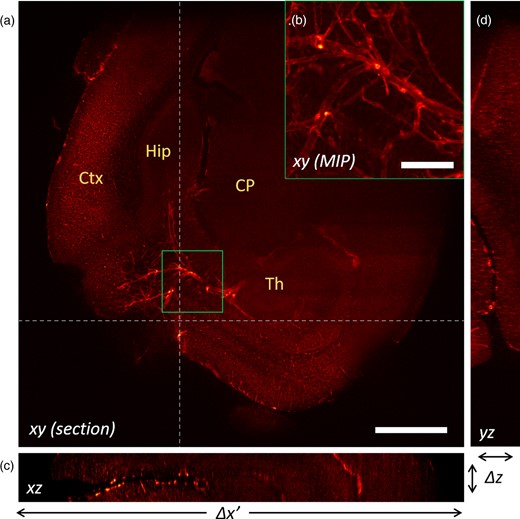 Reconstruction of a mouse brain at 2× magnification. (a) Reconstructed xy-plane of the sample. The cortex (Ctx), hippocampus (Hip), caudoputamen (CP), and thalamus (Th) are visible. (b) Maximum Intensity Projection of the detail highlighted in the green square in panel (a). The big calibre vessels likely include branches from the posterior cerebral artery, the hippocampal arteries, and veins and the thalamoperforating arteries. (c) Reconstructed xz-plane. (d) Reconstructed yz-plane. Scale bar is 1 mm in (a) and 200 μm in (b).