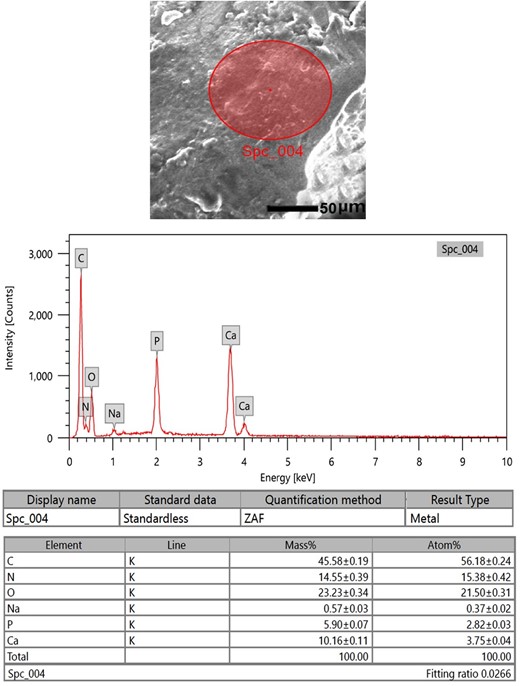 SEM-EDX investigation of the Ossa cordis dextrum cartilaginous surface. SEM-EDX image, graphical representation, and table of elements and their masses. The expressed elements were carbon, oxygen, nitrogen, calcium, phosphorus, and sodium.